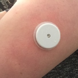 The Freestyle Libre is a great system to use.